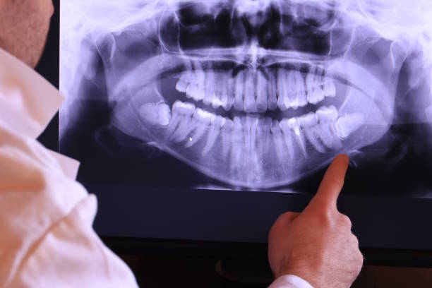 Best Emergency Broken Tooth Repair in Cumings, TX
