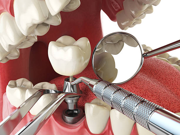 Best 24-Hour Emergency Dentist in Cumings, TX